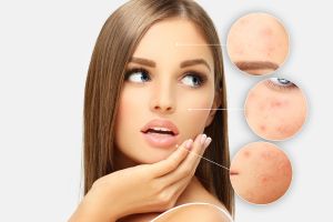 Capricho Beauty Supply. SOS Skin: How to Solve Common Skin Care Problems. Whether it's acne, dry skin, aging, or sensitivity, each problem has a tailor-made solution.